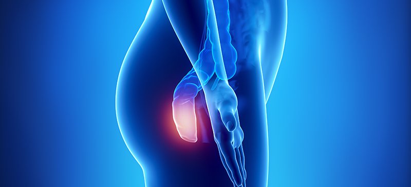 Είναι οι αιμορροΐδες επικίνδυνες για την υγεία μας; Ποιος είναι ο καλύτερος τρόπος θεραπείας; 14 Είναι οι αιμορροΐδες επικίνδυνες για την υγεία μας; Ποιος είναι ο καλύτερος τρόπος θεραπείας;