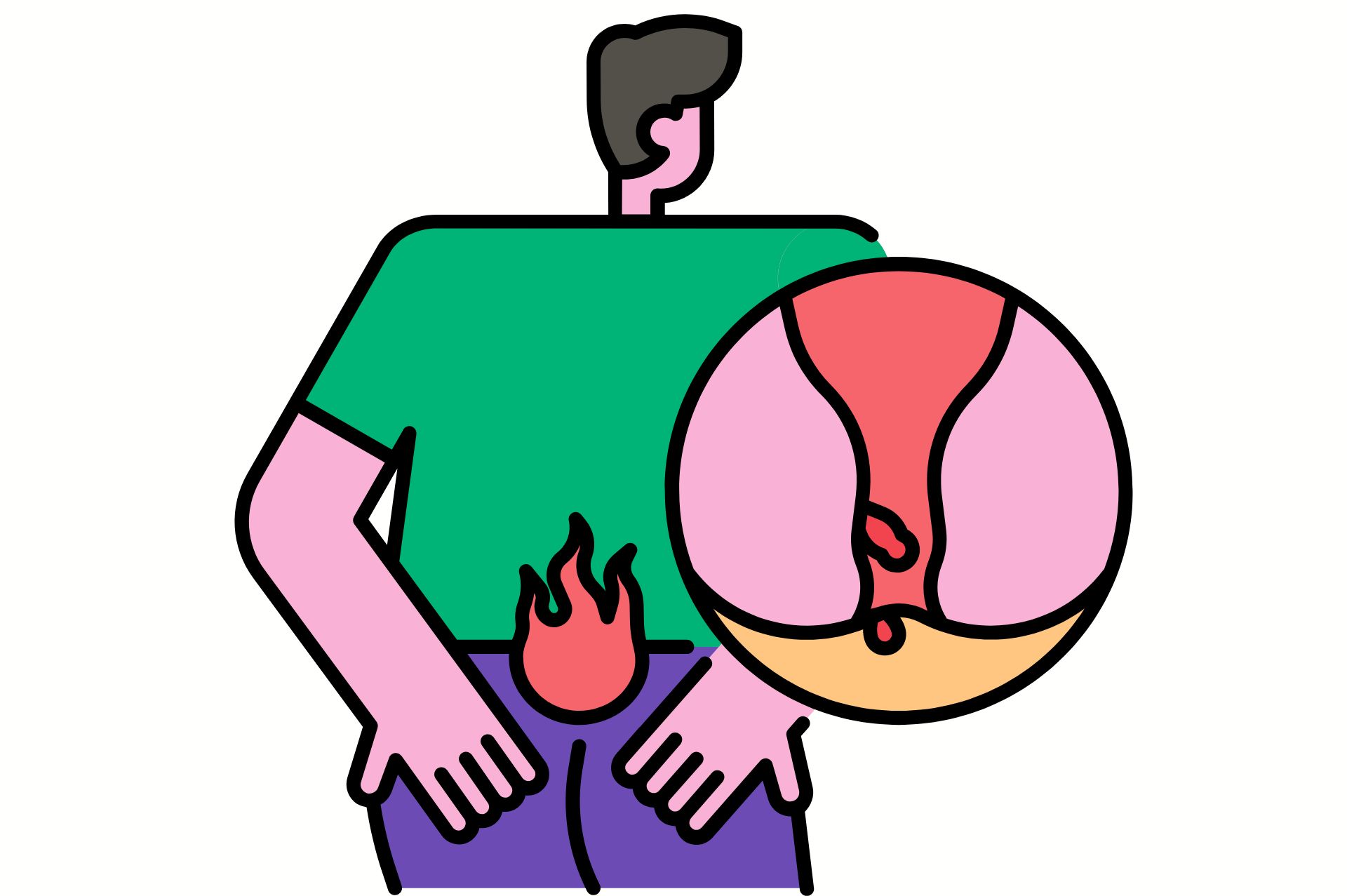 Αιμορροΐδες το Καλοκαίρι