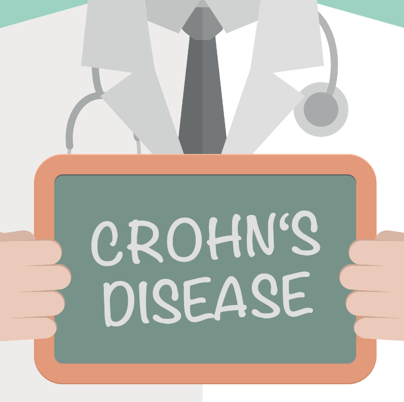 Νόσος του Crohn: Τι είναι και πώς επηρεάζει τον οργανισμό συνολικά 14 Νόσος του Crohn: Τι είναι και πώς επηρεάζει τον οργανισμό συνολικά