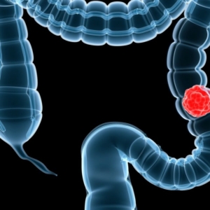 Πως Γίνεται η Κλινική Εξέταση; 1 Πως Γίνεται η Κλινική Εξέταση;