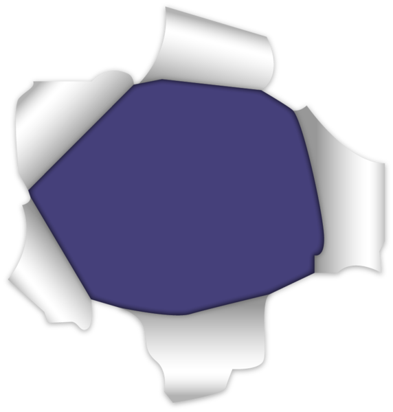 Ραγάδα πρωκτού: Τι είναι, πώς μπορούμε να την προλάβουμε και ποιος είναι ο καλύτερος τρόπος θεραπείας 14 Ραγάδα πρωκτού: Τι είναι, πώς μπορούμε να την προλάβουμε και ποιος είναι ο καλύτερος τρόπος θεραπείας