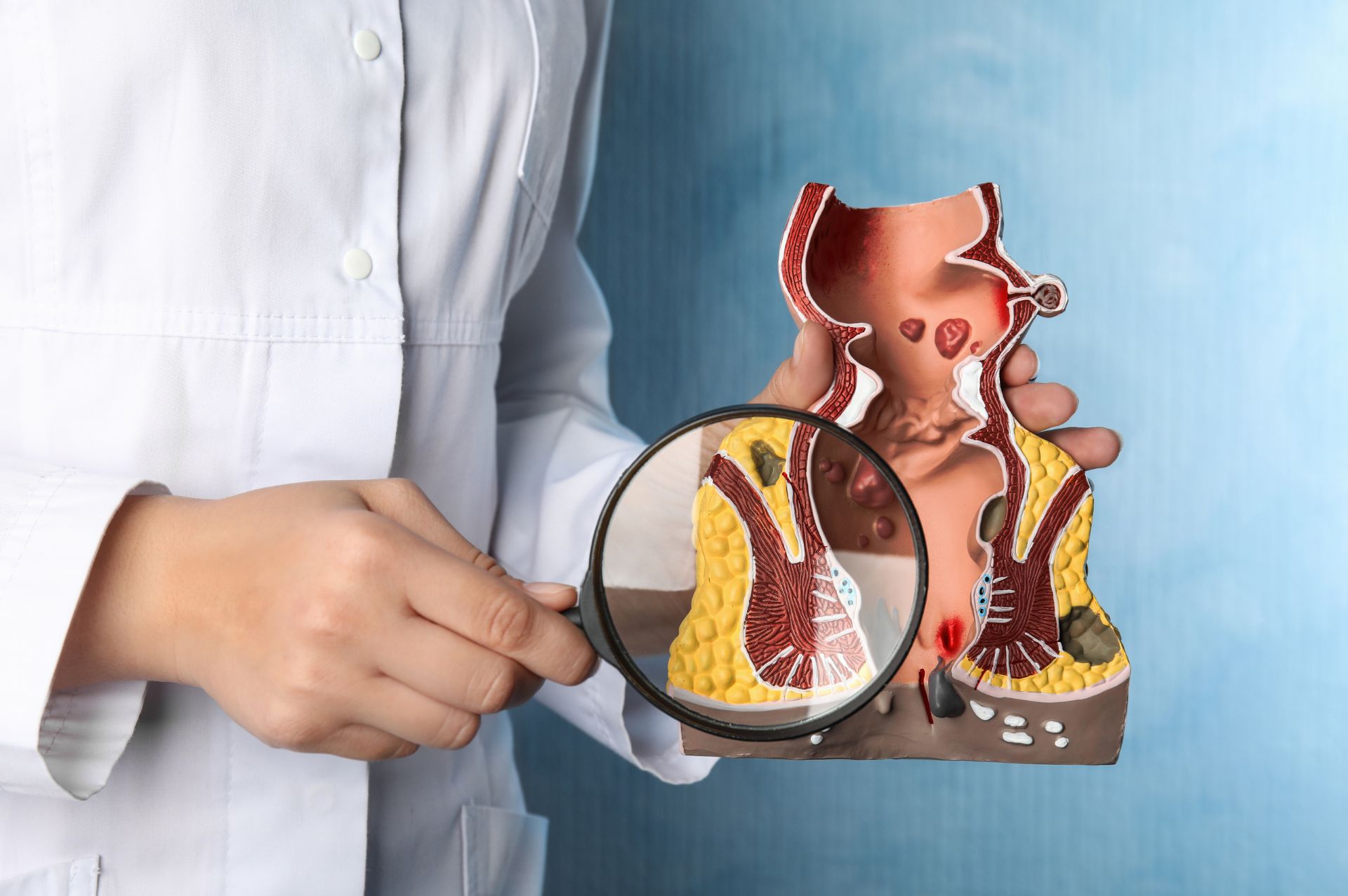 ραγάδα πρωκτού