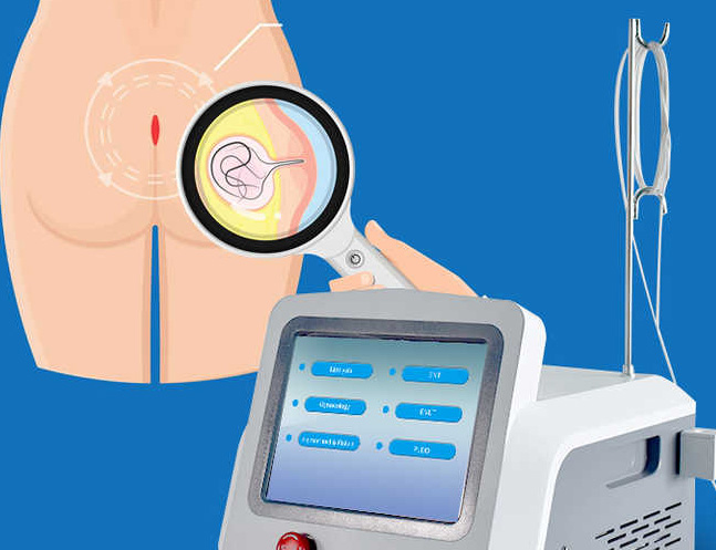 Ειδικό πρωκτολογικό κέντρο Proctoclinic - αιμορροΐδες - κύστη κόκκυγα - ραγάδα πρωκτού - συρίγγιο πρωκτού